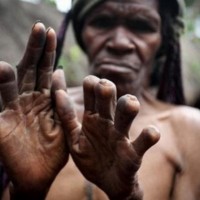 Ekstrim, Suku Dani Papua Punya Tradisi Potong Jari